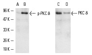 Western blot detection of PKC δ phosphorylation using untreated (A,C) and PMA-treated (B,D) HeLa cells. Blots were probed with p-PKC δ (Thr 507)-R: sc-11770-R (A,B) and PKC δ (C-20)-G: sc-937-G (C,D).