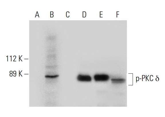 Western blot analysis of PKC phosphorylation in untreated (A,D), pervanadate treated (B,E) and pervanadate treated and lambda protein phosphatase (sc-200312A) treated (C,F) A-431 whole cell lysates. Antibodies tested include p-PKC (Tyr 52)-R: sc-18362-R (A,B,C) and PKC (C-20): sc-937 (D,E,F).