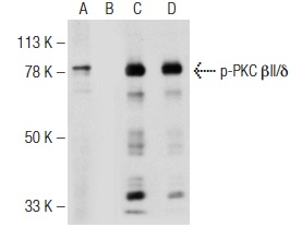 Western blot analysis of PKC βIl/δ phosphorylation in untreated (A,C) and lambda protein phosphatase (sc-200312A) treated (B,D) U-937 whole cell lysates. Antibodies tested include p-PKC βIl/δ (Ser 660)-R: sc-11760-R (A,B) and PKC δ (C-20): sc-937 (C,D).