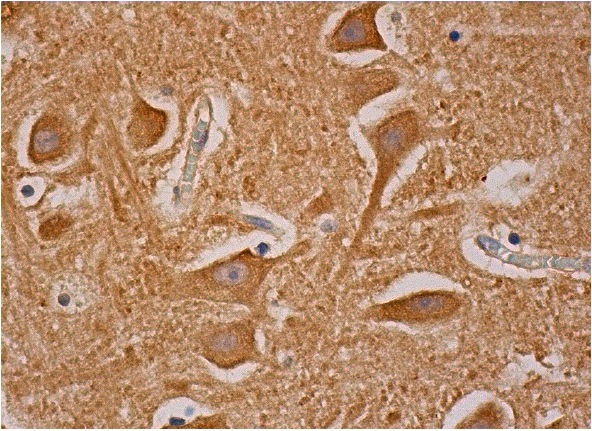PKC ε (C-15)-G: sc-214-G. Immunoperoxidase staining of formalin fixed, paraffin-embedded human cerebral cortex tissue showing cytoplasmic staining of neuronal cells and neuropil staining.