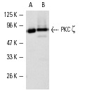 PKC ζ (H-1): sc-17781. Western blot analysis of PKC ζ expression in AML-193 (A) and 3611-RF (B) whole cell lysates.