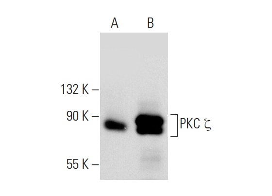 PKC ζ (H-1): sc-17781. Western blot analysis of PKC ζ expression in non-transfected: sc-110760 (A) and human PKC ζ transfected: sc-159616 (B) 293 whole cell lysates.