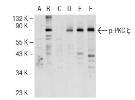 Western blot analysis of PKC ζ phosphorylation in non-transfected: sc-117752 (A,D), untreated human PKC ζ transfected: sc-170980 (B,E) and lambda protein phosphatase treated human PKC ζ transfected: sc-170980 (C,F) 293T whole cell lysates. Antibodies tested include p-PKC ζ (Thr 410)-R: sc-12894-R (A,B,C) and PKC ζ (H-1): sc-17781 (D,E,F).
