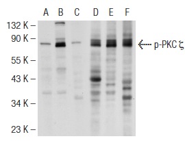 Western blot analysis of PKC ζ phosphorylation in untreated (A,D), PMA treated (B,E) and PMA and lambda protein phosphatase treated (C,F) HeLa whole cell lysates. Antibodies tested include p-PKC ζ (Thr 410)-R: sc-12894-R (A,B,C) and PKC ζ (H-1): sc-17781 (D,E,F).