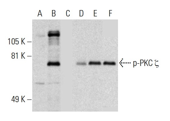 Western blot analysis of PKC ζ phosphorylation in non-transfected: sc-117752 (A,D), untreated human PKC ζ transfected: sc-170980 (B,E) and lambda protein phosphatase (sc-200312A) treated human PKC ζ transfected: sc-170980 (C,F) 293T whole cell lysates. Antibodies tested include p-PKC ζ (Thr 410)-R: sc-12894-R (A,B,C) and PKC ζ (H-1): sc-17781 (D,E,F).