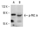 p-PKC δ (Thr 507): sc-11770. Western blot analysis of PKC δ phosphorylation in RAW 264.7 (A) and RAW 264.7 + PMA (B) whole cell lysates.