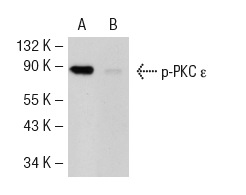 p-PKC ε (Ser 729)-R: sc-12355-R. Western blot analysis of PKC ε phosphorylation in untreated (A) and lambda protein phosphatase treated (B) rat heart tissue extract.