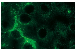 p-PKC ε (Ser 729)-R: sc-12355-R. Immunofluorescence staining of methanol-fixed PMA-treated HeLa cells showing cytoplasmic localization.