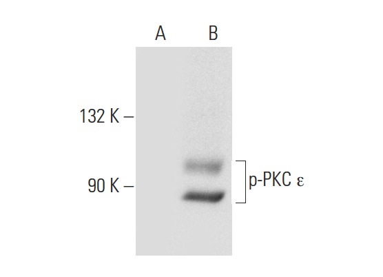 p-PKC (Ser 729)-R: sc-12355-R. Western blot analysis of PKC phosphorylation in PMA treated (A) and PMA and lambda protein phosphatase treated (B) HeLa whole cell lysates.