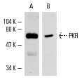 Western blot analysis of PKR expression in NIH/3T3 (A,B) whole cell lysates. Antibodies tested include PKR (M-515): sc-1702 (A) and PKR (B-10): sc-6282 (B).
