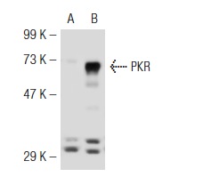 PKR (B-10): sc-6282. Western blot analysis of PKR expression in non-transfected: sc-117752 (A) and mouse PKR transfected: sc-122612 (B) 293T whole cell lysates.