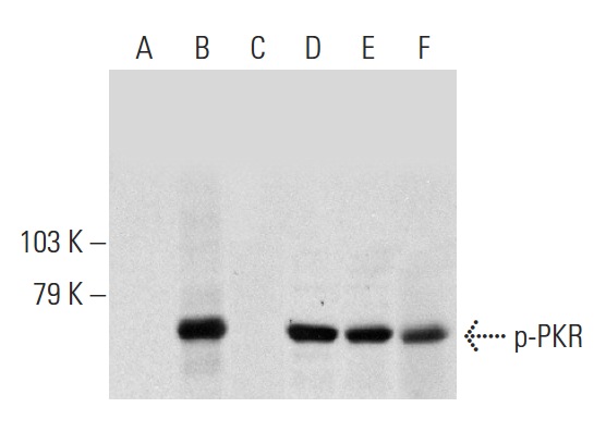 Western blot analysis of PKR phosphorylation in untreated (A,D), calyculin A treated (B,E) and lambda protein phosphatase (sc-200312A) treated (C,F) HeLa whole cell lysates. Antibodies tested include p-PKR (Thr 451): sc-101784 (A,B,C) and PKR (B-10): sc-6282 (D,E,F).