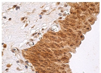 PKR (B-10): sc-6282. Immunoperoxidase staining of formalin fixed, paraffin-embedded human urinary bladder tissue showing cytoplasmic and nuclear staining of urothelial cells.