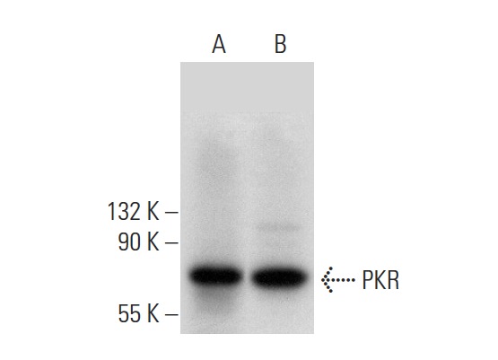PKR (B-10): sc-6282. Western blot analysis of PKR expression in HeLa (A) and BJAB (B) whole cell lysates.