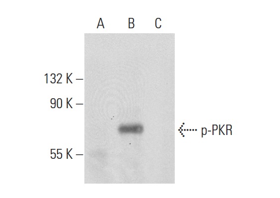 p-PKR (Thr 451): sc-101784. Western blot analysis of PKR phosphorylation in untreated (A), calyculin A treated (B) and calyclulin A and lambda protein phosphatase treated (C) HeLa whole cell lysates.