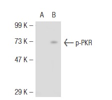 p-PKR (Thr 451): sc-101784. Western blot analysis of PKR phosphorylation in non-transfected: sc-117752 (A) and mouse PKR transfected: sc-122612 (B) 293T whole cell lysates.