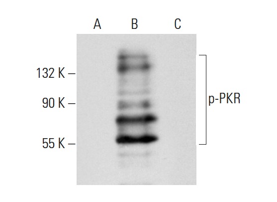 p-PKR (Thr 451): sc-101784. Western blot analysis of PKR phosphorylation in untreated (A), calyculin A and IFNα treated (B) and calyculin A, IFNα and lambda protein phosphatase treated (C) HeLa whole cell lysates.