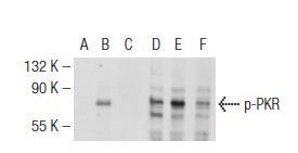 Western blot analysis of PKR phosphorylation in untreated (A,D), calyculin treated (B,E) and calyculin and lambda protein phosphatase treated (C,F) HeLa whole cell lysates. Antibodies tested include p-PKR (Thr 451): sc-101784 (A,B,C) and PKR (M-515): sc-1702 (D,E,F).