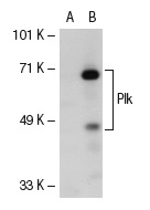 Plk (H-152): sc-5585. Western blot analysis of Plk expression in non-transfected: sc-110760 (A) and human Plk transfected: sc-111085 (B) 293 whole cell lysates.