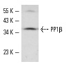 PP1β (N-19): sc-6107. Western blot analysis of PP1β expression in HeLa whole cell lysate.