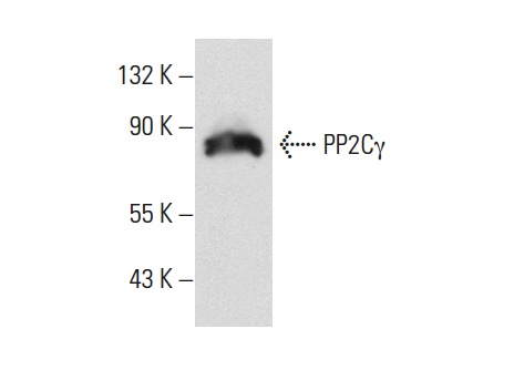 PP2Cγ (k1G6): sc-135627. Western blot analysis of PP2Cγ expression in Jurkat whole cell lysate.