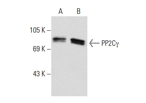PP2Cγ (k1G6): sc-135627. Western blot analysis of PP2Cγ expression in non-transfected: sc-117752 (A) and human PP2Cγ transfected: sc-172531 (B) 293T whole cell lysates.