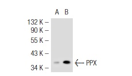 PPX (C-18): sc-6118. Western blot analysis of PPX expression in non-transfected: sc-117752 (A) and mouse PPX transfected: sc-127375 (B) 293T whole cell lysates.
