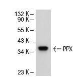 PPX (C-18): sc-6118. Western blot analysis of PPX expression in HeLa whole cell lysate.