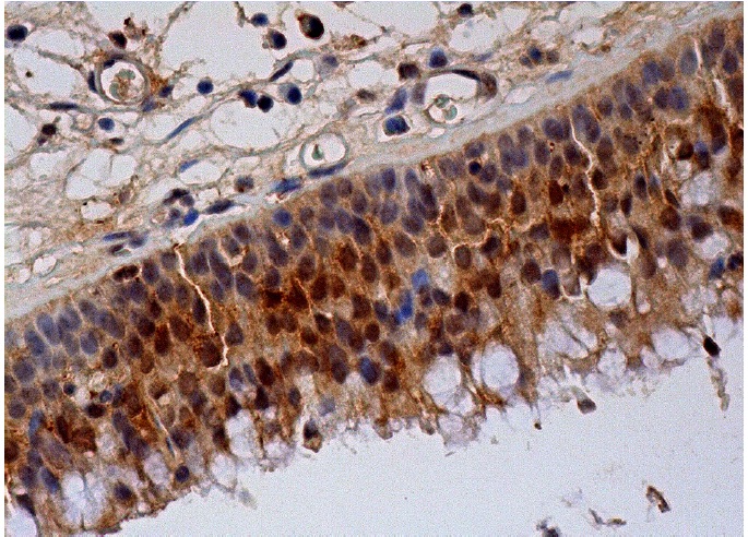 PPX Antibody (C-18): sc-6118. Immunoperoxidase staining of formalin fixed, paraffin-embedded human nasopharynx tissue showing nuclear and cytoplasmic staining of respiratory epithelial cells.