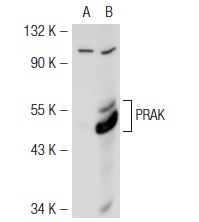 PRAK (H-180): sc-25419. Western blot analysis of PRAK expression in non-transfected: sc-117752 (A) and mouse PRAK transfected: sc-122746 (B) 293T whole cell lysates.