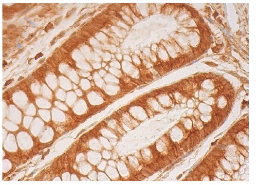 PRAK (H-180): sc-25419. Immunoperoxidase staining of formalin fixed, paraffin-embedded human rectum tissue showing cytoplasmic and nuclear staining of glandular cells.