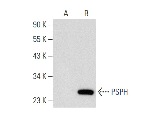 PSPH (I-19): sc-74827. Western blot analysis of PSPH expression in non-transfected: sc-117752 (A) and mouse PSPH transfected: sc-122827 (B) 293T whole cell lysates.