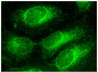 PSPH (I-19): sc-74827. Immunofluorescence staining of formalin-fixed HeLa cells showing cytoplasmic localization.