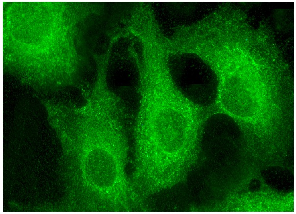 PSPH (I-19): sc-74827. Immunofluorescence staining of formalin-fixed HepG2 cells showing cytoplasmic localization.