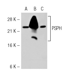 PSPH (3G12): sc-69704. Western blot analysis of PSPH expression in non-transfected 293T: sc-117752 (A), human PSPH transfected 293T: sc-116691 (B) and K-562 (C) whole cell lysates.
