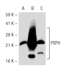 PSPH (3G12): sc-69704. Western blot analysis of PSPH expression in non-transfected 293T: sc-117752 (A), mouse PSPH transfected 293T: sc-122827 (B) and Hep G2 (C) whole cell lysates.