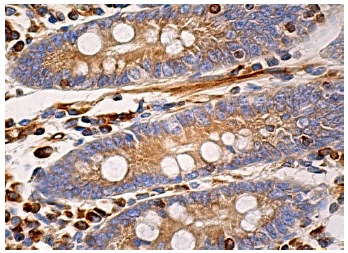 PTP1B (D-4): sc-133259. Immunoperoxidase staining of formalin fixed, paraffin-embedded human small intestine tissue showing cytoplasmic staining of glandular and interstitial cells.