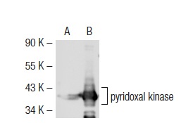 pyridoxal kinase (H-91): sc-67361. Western blot analysis of pyridoxal kinase expression in non-transfected: sc-117752 (A) and mouse pyridoxal kinase transfected: sc-122859 (B) 293T whole cell lysates.