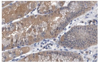 pyridoxal kinase (H-91): sc-67361. Immunoperoxidase staining of formalin fixed, paraffin-embedded human stomach showing cytoplasmic staining of glandular cells at high magnification. Kindly provided by The Swedish Human Protein Atlas (HPA) program.