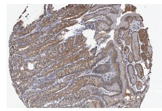 pyridoxal kinase (H-91): sc-67361. Immunoperoxidase staining of formalin fixed, paraffin-embedded human stomach showing cytoplasmic staining of glandular cells at low magnification. Kindly provided by The Swedish Human Protein Atlas (HPA) program.