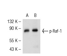 p-Raf-1 (Tyr 340/341)-R: sc-16806-R. Western blot analysis of Raf-1 phosphorylation in non-transfected: sc-117752 (A) and human Raf-1 transfected: sc-158911 (B) 293T whole cell lysates.