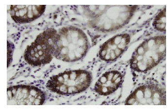 Rhotekin (AA-18): sc-100426. Immunoperoxidase staining of formalin-fixed, paraffin-embedded human colon tissue showing cytoplasmic localization.