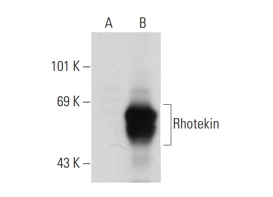Rhotekin (AA-18): sc-100426. Western blot analysis of Rhotekin expression in non-transfected: sc-117752 (A) and human Rhotekin transfected: sc-112761 (B) 293T whole cell lysates.