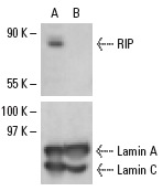 RIP siRNA (h): sc-36426. Western blot analysis of RIP expression in non-transfected control (A) and RIP siRNA transfected (B) HeLa cells. Blot probed with RIP (K-20): sc-1169. Lamin A/C (H-110): sc-20681 used as specificity and loading control.