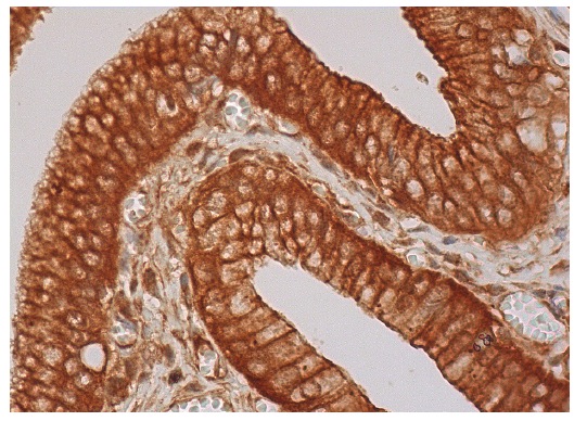 RIP (K-20): sc-1169. Immunoperoxidase staining of formalin fixed, paraffin-embedded human gall bladder tissue showing cytoplasmic and membrane staining of glandular cells.