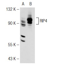 RIP4 (C-16): sc-83320. Western blot analysis of RIP4 expression in non-transfected: sc-117752 (A) and human RIP4 transfected: sc-177871 (B) 293T whole cell lysates.