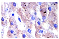 Rock-1 (C-19): sc-6055. Immunoperoxidase staining of formalin-fixed, paraffin-embedded human liver tissue showing cytoplasmic staining.