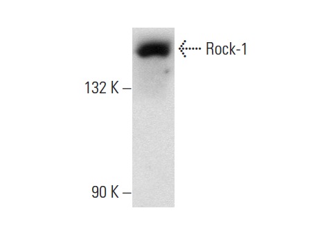 Rock-1 (C-19): sc-6055. Western blot analysis of Rock-1 expression in MDCK whole cell lysate.