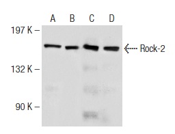 Rock-2 (C-20): sc-1851. Western blot analysis of Rock-2 expression in Sol8 (A) and A-10 (B) whole cell lysates and in mouse (C) and rat (D) brain extracts.