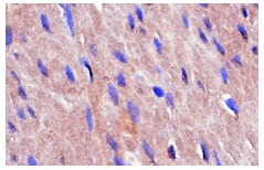 Rock-2 (C-20): sc-1851. Immunoperoxidase staining of formalin-fixed, paraffin-embedded human colon tissue showing cytoplasmic staining.